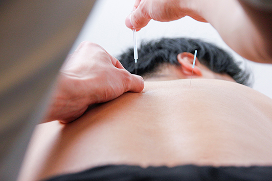 acupuncture-treatment_08