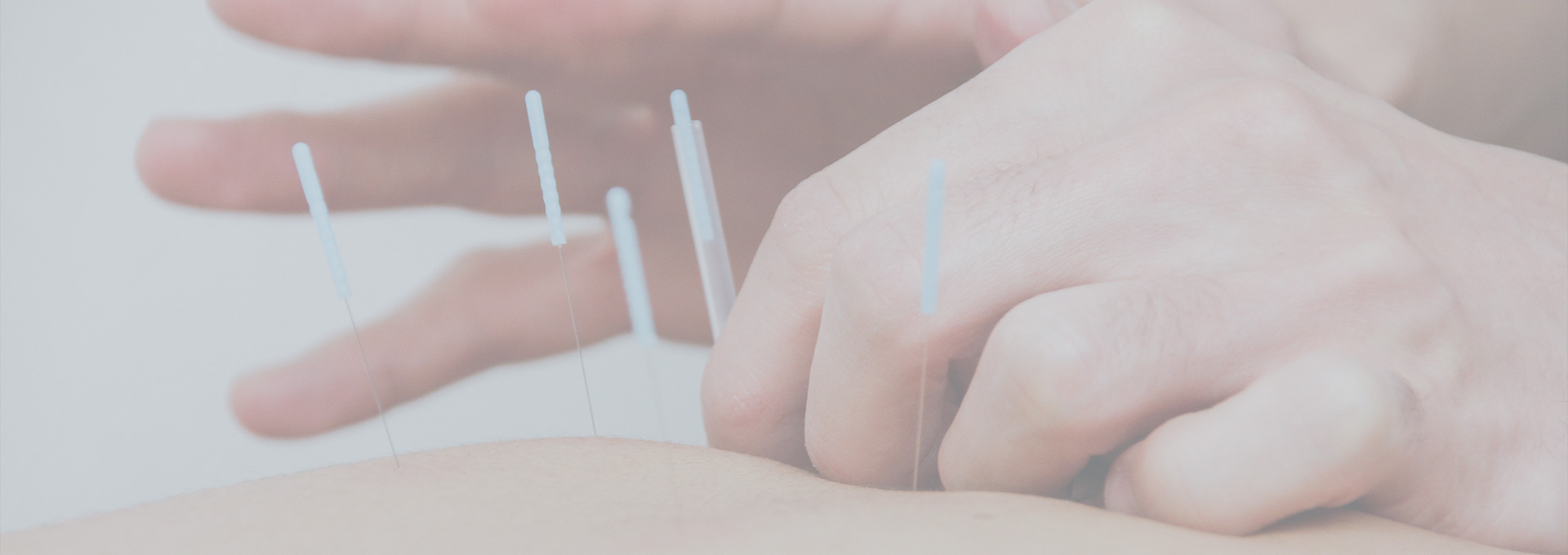 Acupuncture