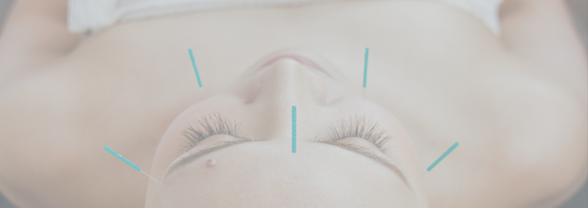 Beauty-acupuncture